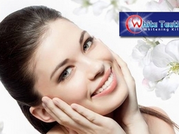 http://www.whiteteethwhiteningkits.co.uk/teeth-whitening-kits/ website