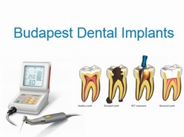 http://www.budapest-implants.com/ website